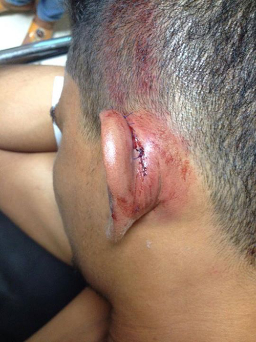 VICTIMA DEL TERROR DEL ESMAD
