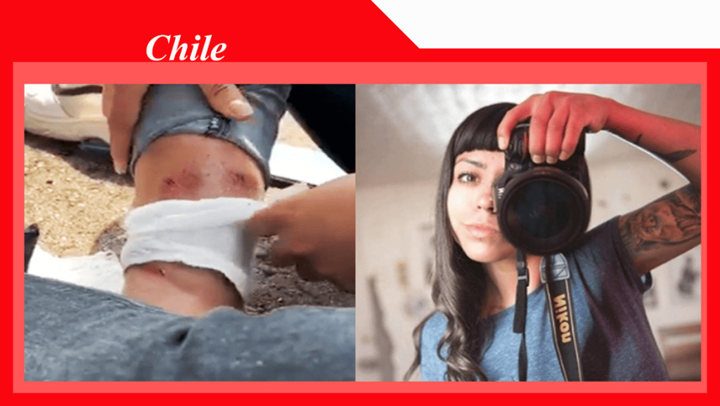 Desertores hieren a fotógrafa chilena y Sebastián Piñera los recibe en el lado colombiano como&nbsp;héroes