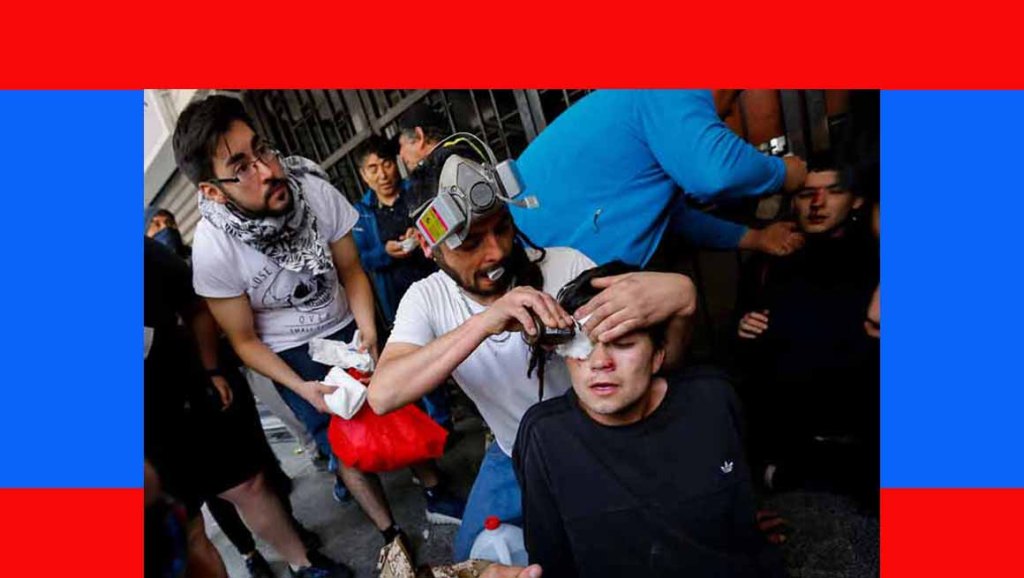 Víctimas de traumas oculares en Chile reclaman&nbsp;reparación
