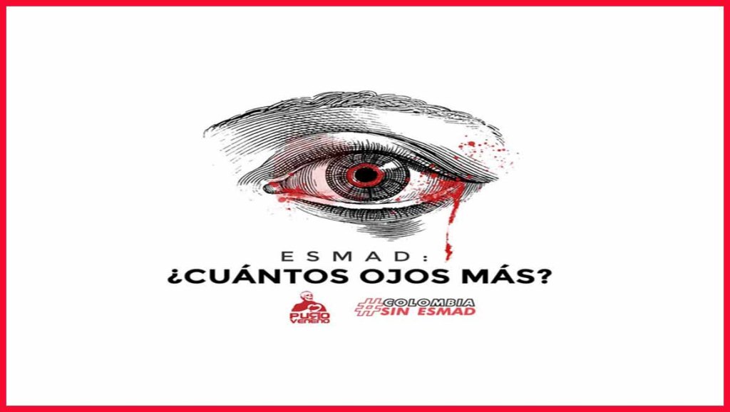 A Cristian Rodríguez el ojo no se le “perdió”…El ESMAD se lo&nbsp;sacó