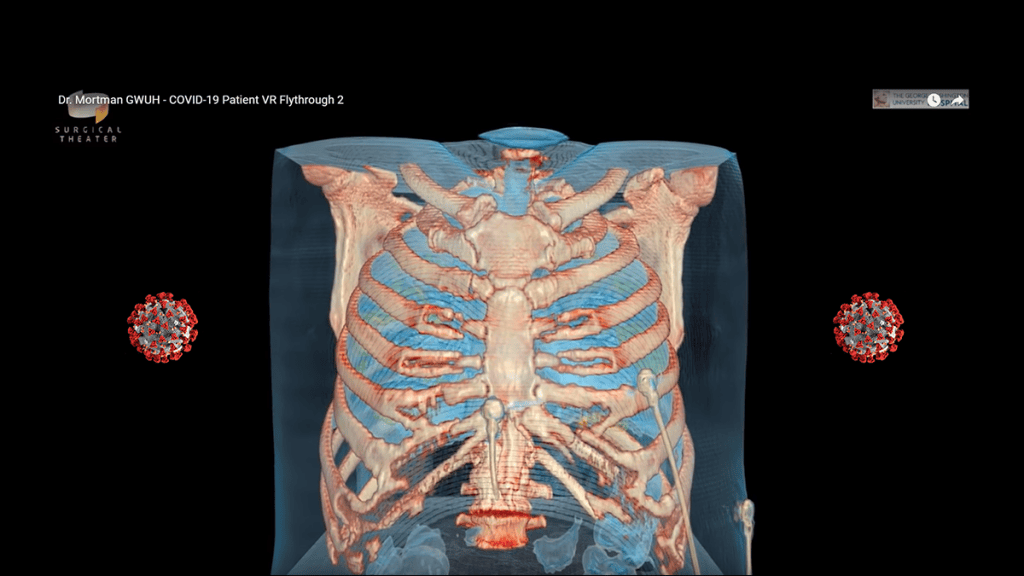 La realidad virtual muestra cómo el coronavirus puede dañar los pulmones |&nbsp;Vídeo