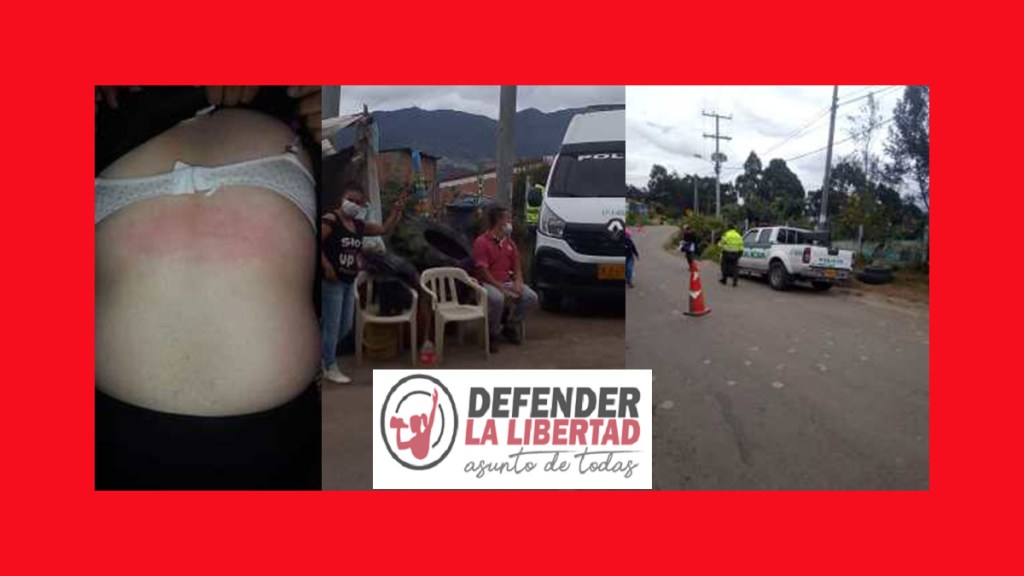 Policía agrede con Choques eléctricos a mujeres que gestionaban un punto biológico en Ciudad&nbsp;Bolívar