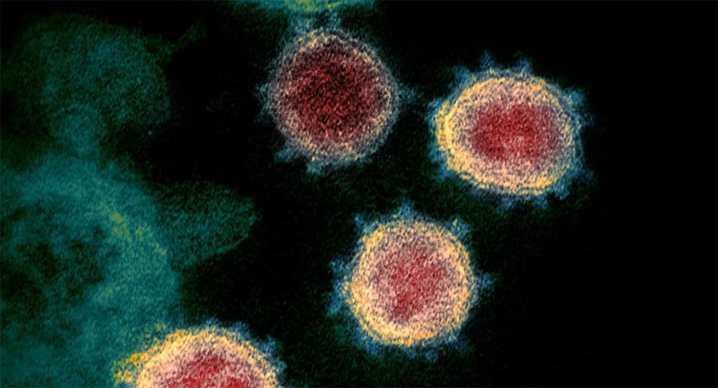 Científicos revelan la humedad óptima para frenar la propagación del&nbsp;coronavirus