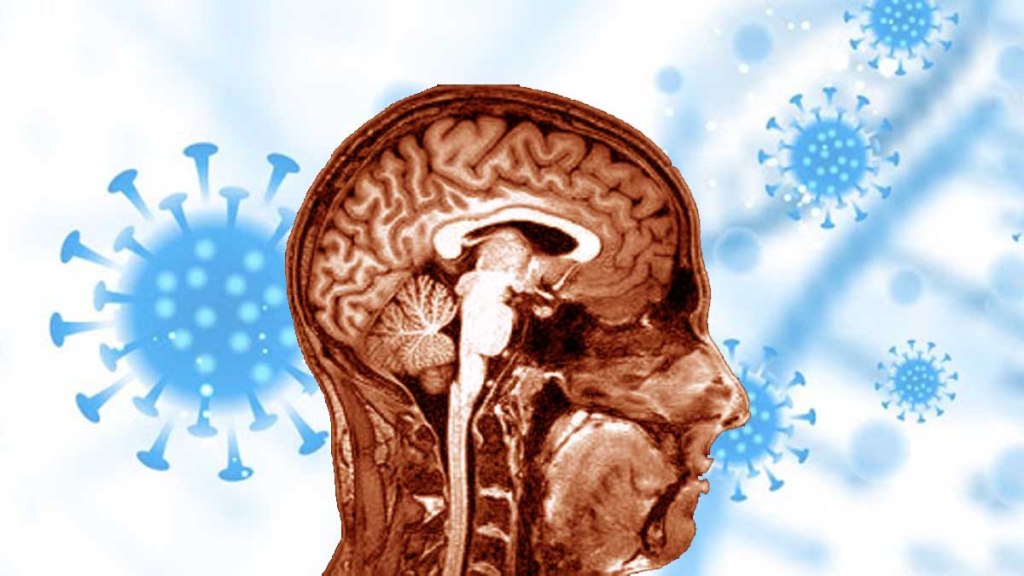 Estudio encuentra que el covid-19 altera el volumen de materia gris en el&nbsp;cerebro
