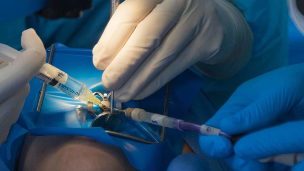 Por primera vez en el mundo, científicos venezolanos regeneran pulpa dental a través del implante de células&nbsp;madre
