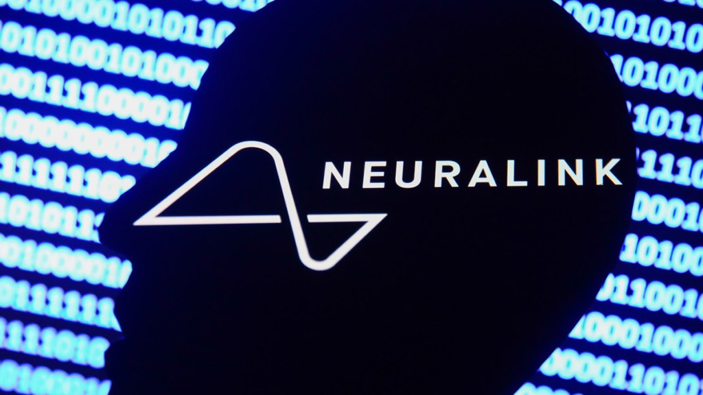 Neuralink busca un socio para ensayos clínicos de implantes cerebrales en&nbsp;humanos