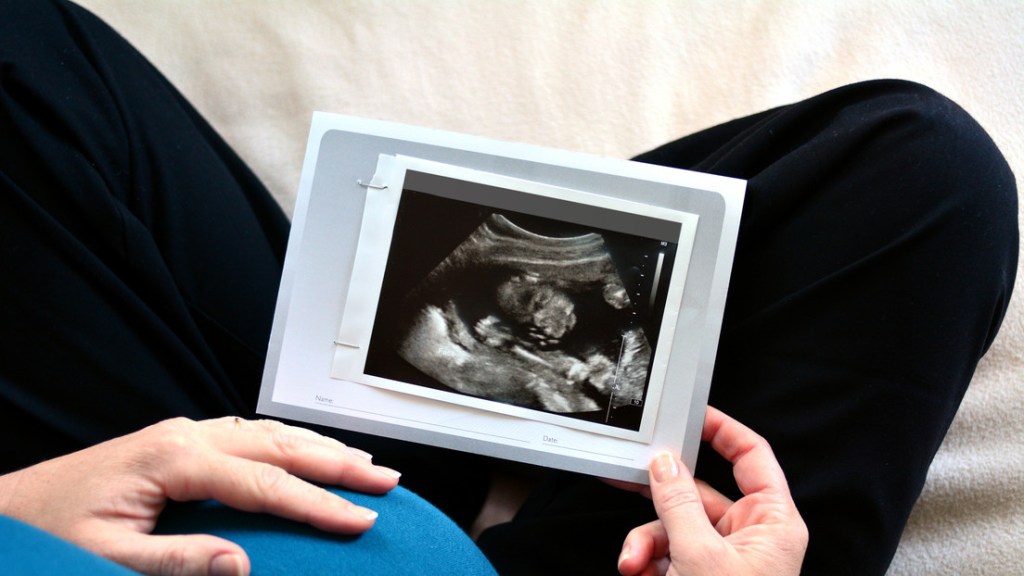 Las tasas de fertilidad auguran un sombrío futuro para la&nbsp;humanidad