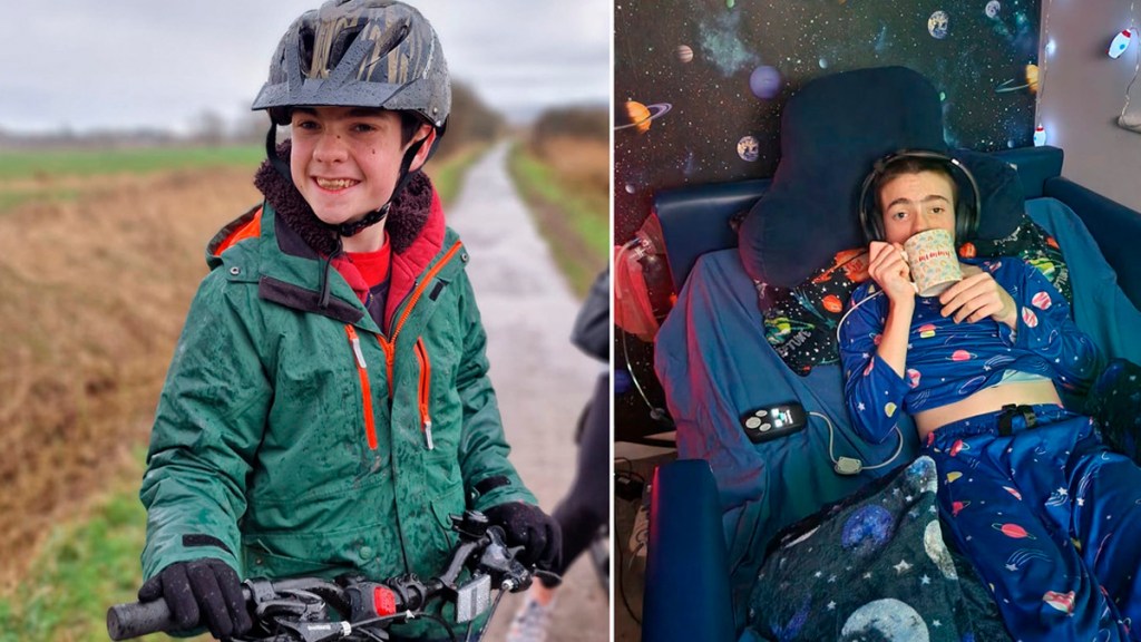 Por primera vez, un niño recibe un neuroestimulador para controlar los ataques de&nbsp;epilepsia