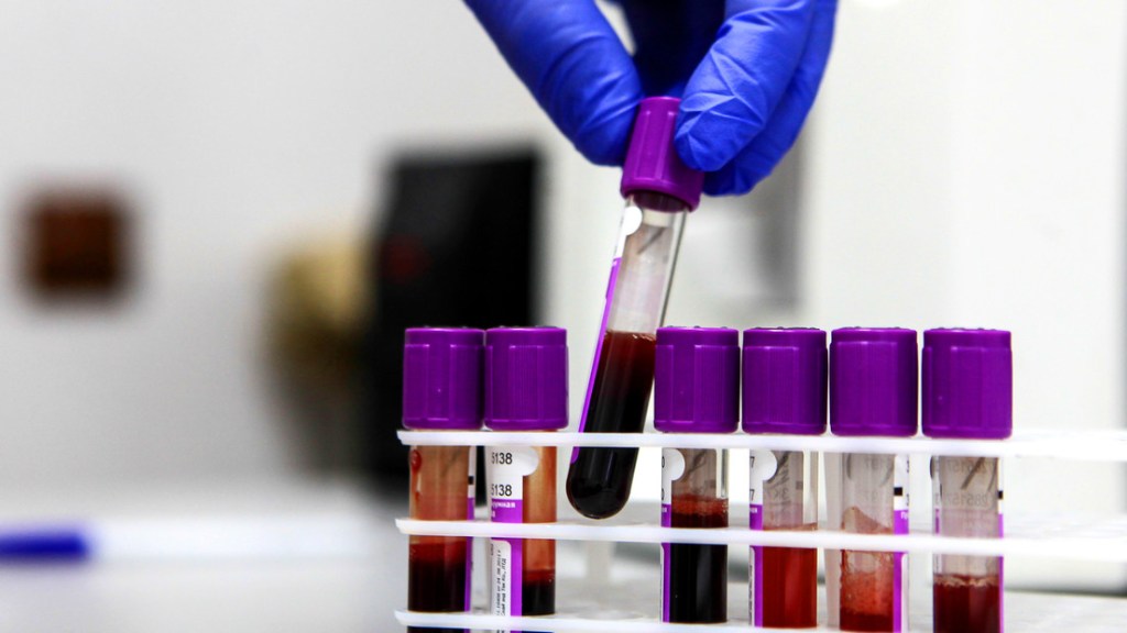 Inician en Rusia los primeros ensayos clínicos de una vacuna contra el&nbsp;cáncer