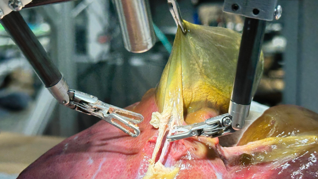 Avance histórico: un robot realiza por primera vez una cirugía realista sin ayuda&nbsp;humana